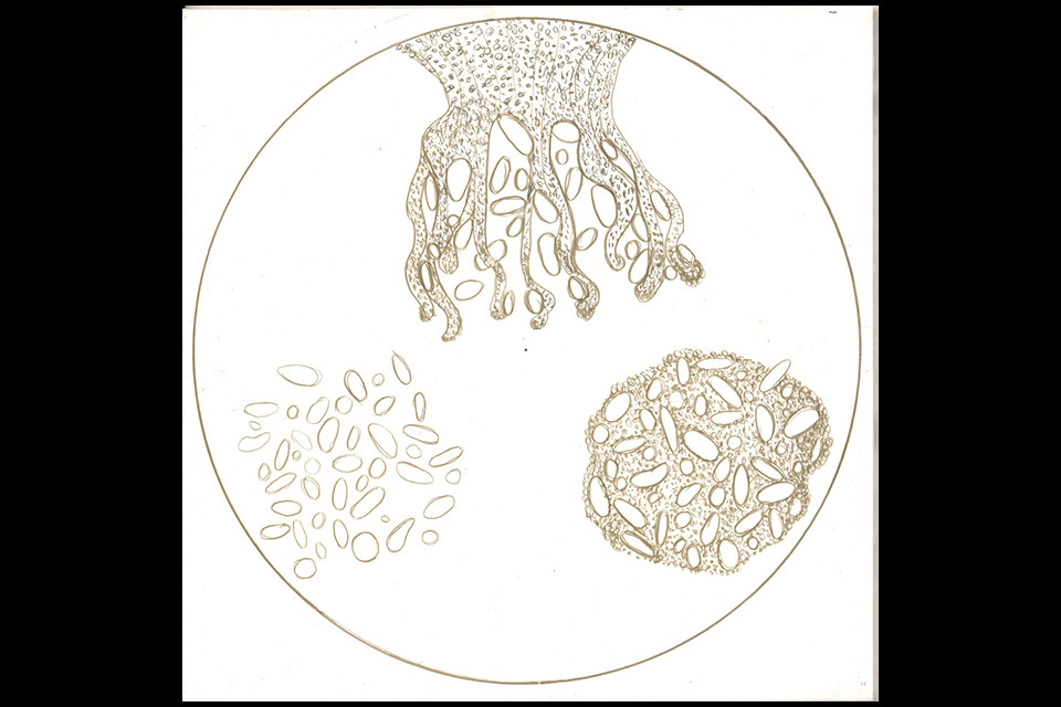 blastula_amoeba-web
